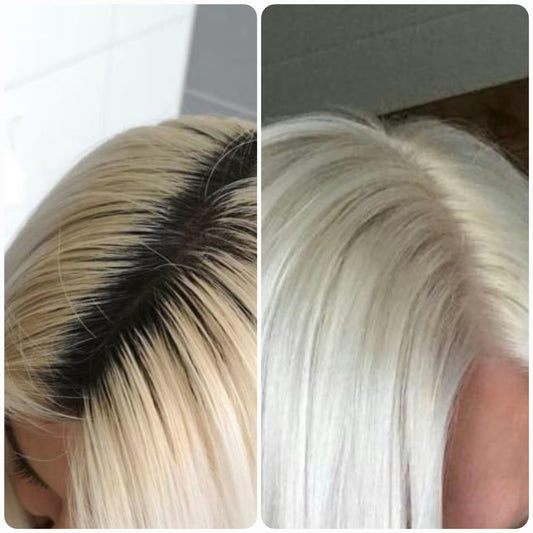 Ansatz bei Platinblond